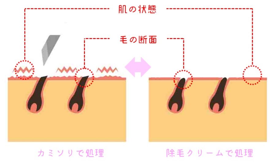 イラスト　カミソリと除毛クリーム　肌と毛の断面比較　図解
